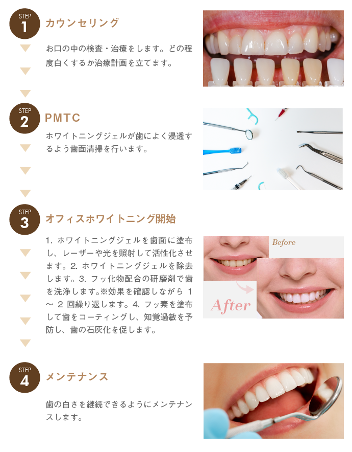 カウンセリングお口の中の検査・治療をします。どの程度白くするか治療計画を立てます。PMTCホワイトニングジェルが歯によく浸透するよう歯面清掃を行います。オフィスホワイトニング1.ホワイトニングジェルを歯面に塗布し、レーザーや光を照射して活性化させます。2.ホワイトニングジェルを除去します。3.フッ化物配合の研磨剤で歯を洗浄します。※効果を確認しながら1～2回繰り返します。4.フッ素を塗布して歯をコーティングし、知覚過敏を予防し、歯の石灰化を促します。メンテナンス歯の白さを継続できるようにメンテナンスします。
